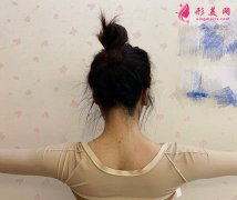 西安同濟(jì)整形美容科吸脂怎么樣？案例效果圖+價格(價目)表總結(jié)