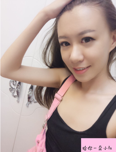 北京純脂馮斌脂肪填充怎么樣?看看術(shù)后效果怎么樣? 北京純脂馮斌脂肪填充怎么樣?看看術(shù)后效果怎么樣?
