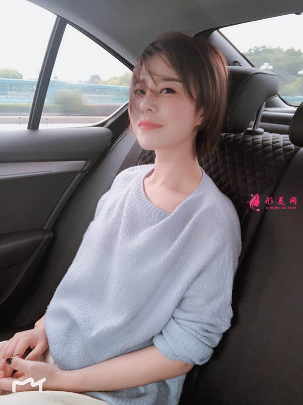 上海華美醫(yī)療美容醫(yī)院徐文龍醫(yī)生膨體隆鼻案例-整容案例 上海華美醫(yī)療美容醫(yī)院徐文龍醫(yī)生膨體隆鼻案例