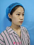 八大處劉劍鋒磨骨怎么樣？醫(yī)生成功案例及收費價格來曝光