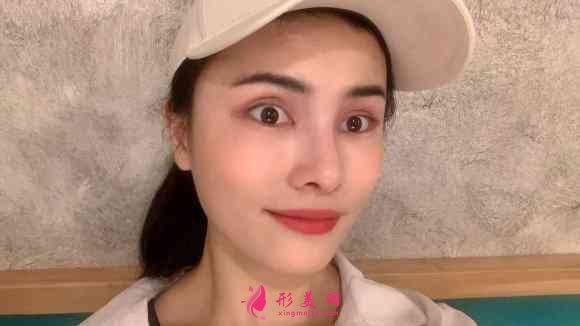 南昌時光整形是三甲醫(yī)院嗎？附玻尿酸隆鼻效果對比及2021價格表發(fā)布