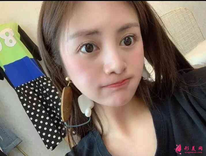 北京畫美醫(yī)療美容醫(yī)怎么樣？2021價(jià)格表公布+玻尿酸豐唇案例分享