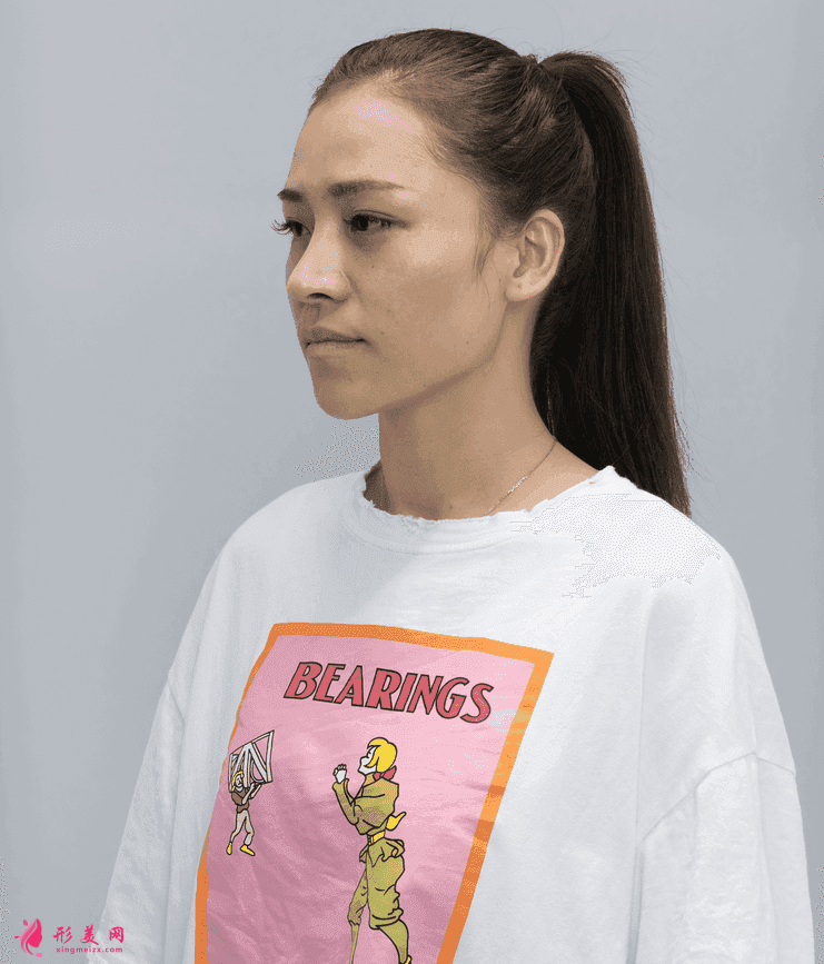 深圳富華美容醫(yī)院口碑怎么樣？2021價格表公開+鼻修復(fù)案例分享