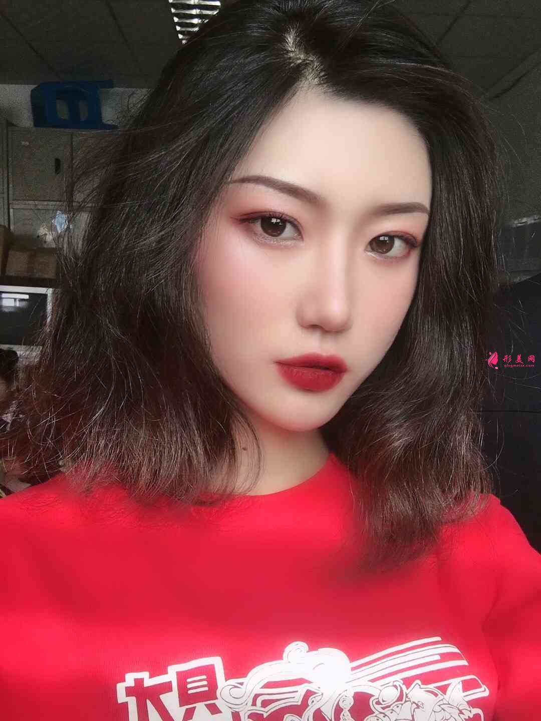 南陽中心醫(yī)院整形科割雙眼皮怎么樣？附雙眼皮案例及2021價格表