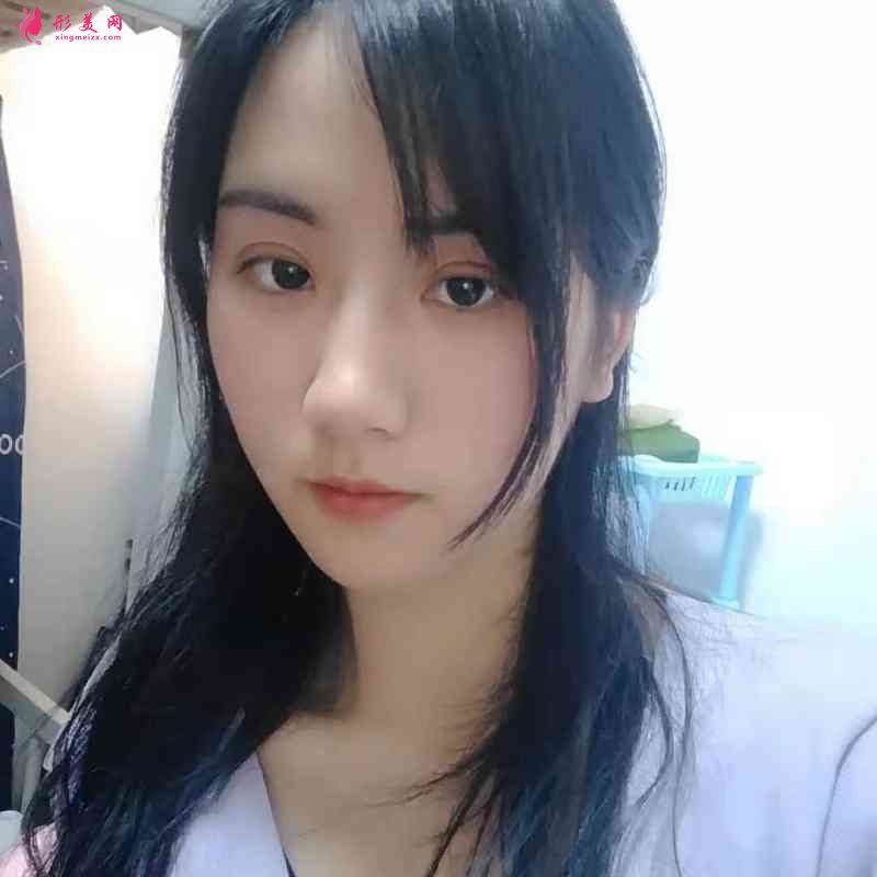 華西整形醫(yī)院做雙眼皮好不好？附雙眼皮案例及2021價格表