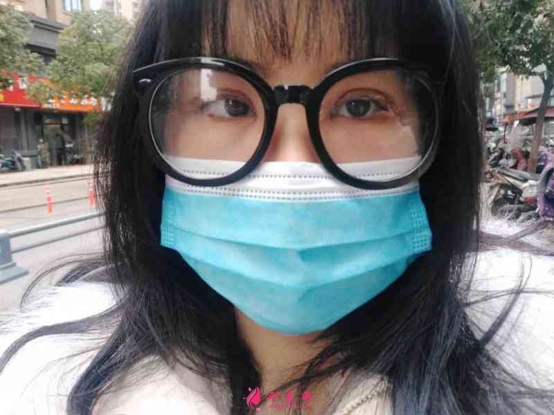 華西整形醫(yī)院做雙眼皮好不好？附雙眼皮案例及2021價格表
