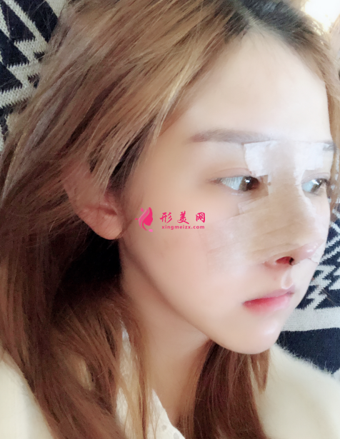 成都蜀尚蓉雅美容整形口碑怎么樣？附醫(yī)院介紹+隆鼻案例分享