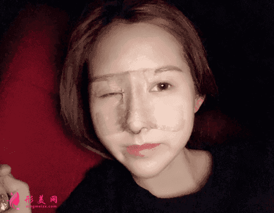 成都蜀尚蓉雅美容整形口碑怎么樣？附醫(yī)院介紹+隆鼻案例分享