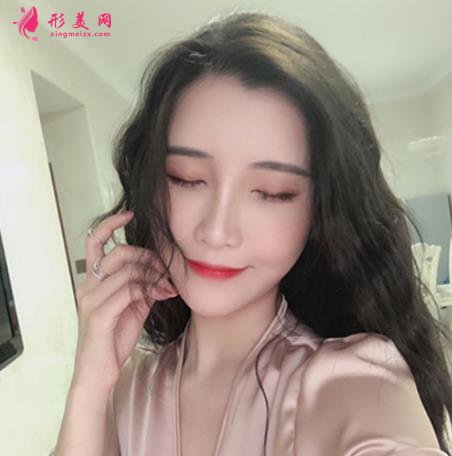 九江整形醫(yī)院那些好？星瑞美、圣嘉麗口碑領(lǐng)銜_除皺案例分享