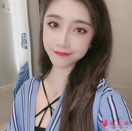 九江整形醫(yī)院那些好？星瑞美、圣嘉麗口碑領(lǐng)銜_除皺案例分享