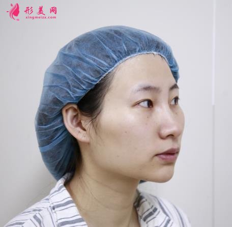 阜陽(yáng)整形美容醫(yī)院排行榜前三強(qiáng)對(duì)外公示！含案例展示