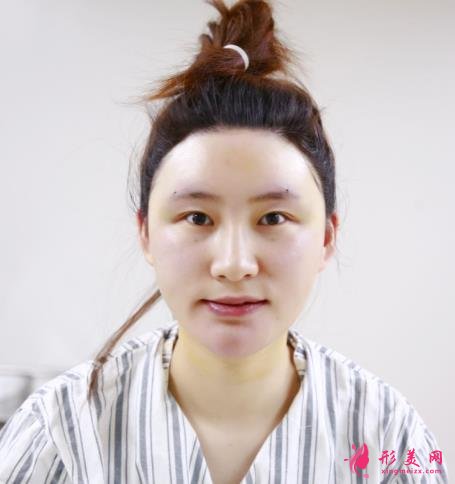 阜陽(yáng)整形美容醫(yī)院排行榜前三強(qiáng)對(duì)外公示！含案例展示