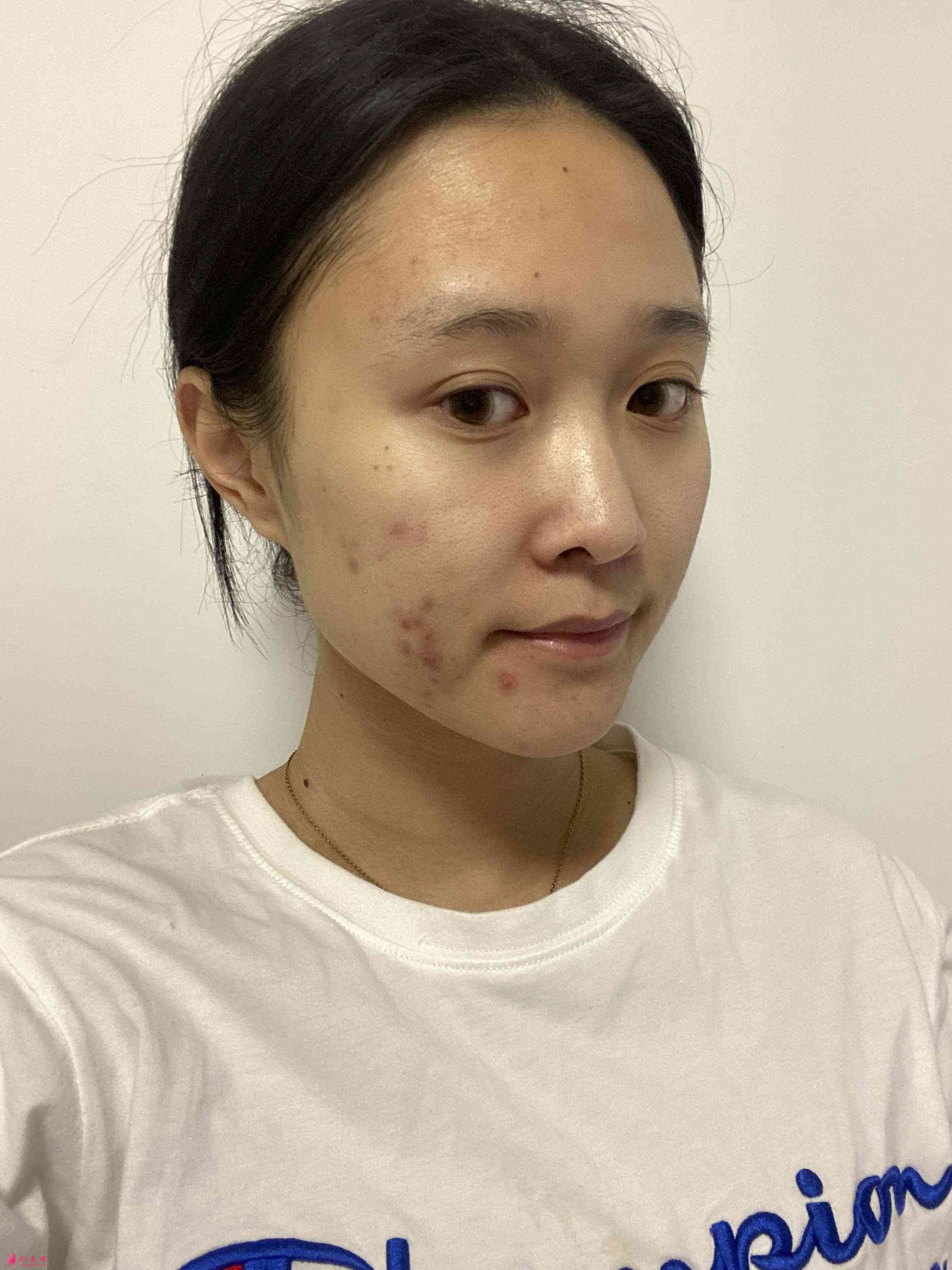 重慶當(dāng)代整形美容醫(yī)院怎樣?2021價(jià)格表發(fā)布+下頜角術(shù)后效果對(duì)比 重慶當(dāng)代整形美容醫(yī)院怎樣?2021價(jià)格表發(fā)布+下頜角術(shù)后效果對(duì)比