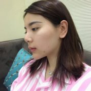 上海長(zhǎng)征醫(yī)院整形科面部吸脂怎么樣？術(shù)后瘦臉效果跟美顏相機(jī)說(shuō)再