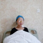 包頭一附院整形科怎么樣?雙眼皮案例實拍對比~術(shù)后效果很不一般