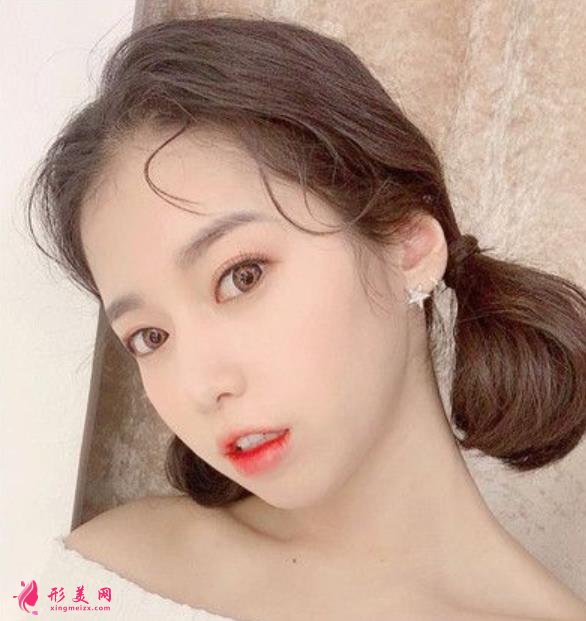 天津第一中心醫(yī)院雙眼皮怎么樣？手術(shù)恢復(fù)過(guò)程無(wú)保留分享給你