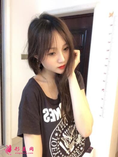 包頭一附院整形科怎么樣?雙眼皮案例實(shí)拍對(duì)比~術(shù)后效果很不一般
