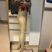 新疆醫(yī)科大學(xué)第一附屬醫(yī)院整形科怎樣？通過真實吸脂案例對比讓你