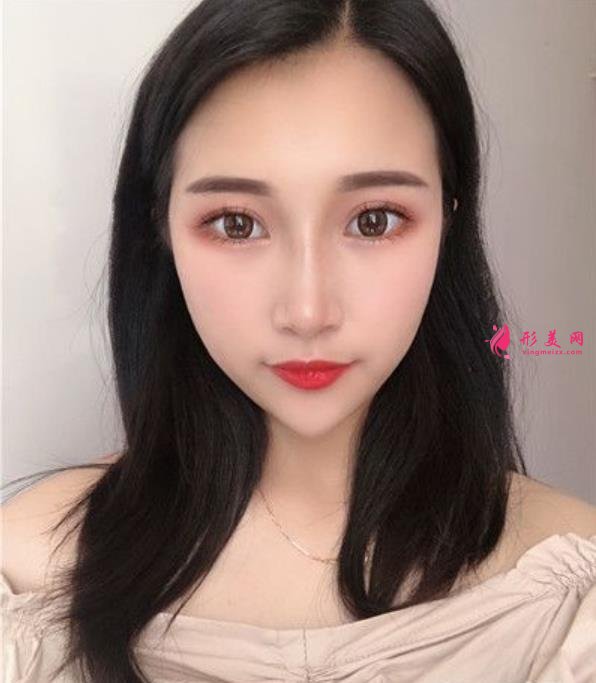 溫州藝星整形美容醫(yī)院做隆鼻怎么樣？好不好？專(zhuān)家案例價(jià)格收費(fèi)一覽