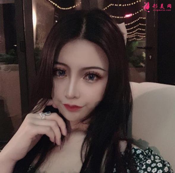 南京友誼醫(yī)院整形科隆鼻案例術(shù)后恢復(fù)過程分享！含全新醫(yī)美價格表