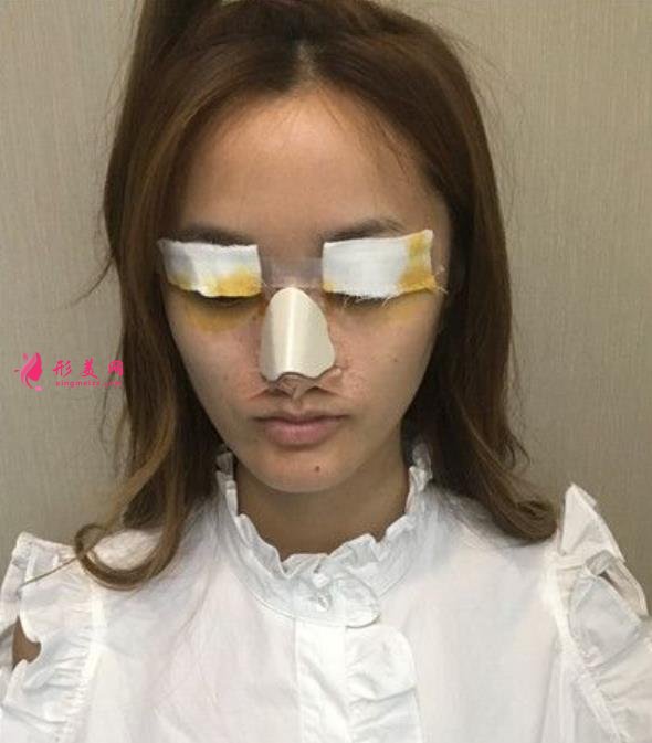 北京同仁醫(yī)院眼綜合怎么樣？多少錢？過來人告訴你真相