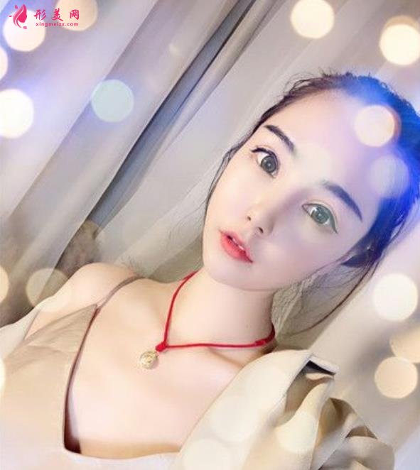 威海市立醫(yī)院眼綜合怎么樣？術(shù)后兩個月恢復(fù)效果分享