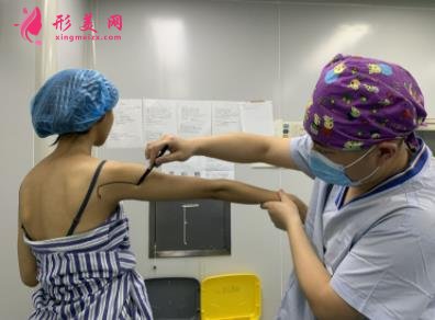 河北工程大學(xué)附屬醫(yī)院整形外科手臂抽脂案例分享！含吸脂價(jià)格表公開