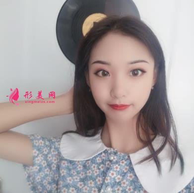 河北工程大學(xué)附屬醫(yī)院整形外科手臂抽脂案例分享！含吸脂價(jià)格表公開