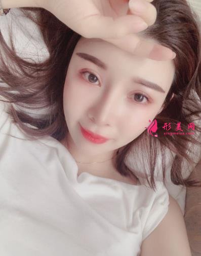 南京康美馮思陽隆鼻怎么樣？看完下面真實(shí)案例及價(jià)格收費(fèi)表再來評(píng)價(jià)