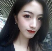 重醫(yī)附二院整形科怎么樣？快來參考埋線雙眼皮案例及價格價目表