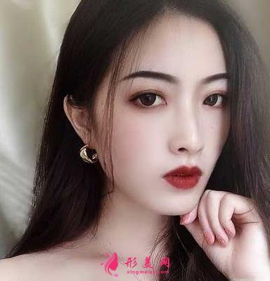 重醫(yī)附二院整形科怎么樣？快來參考埋線雙眼皮案例及價格價目表