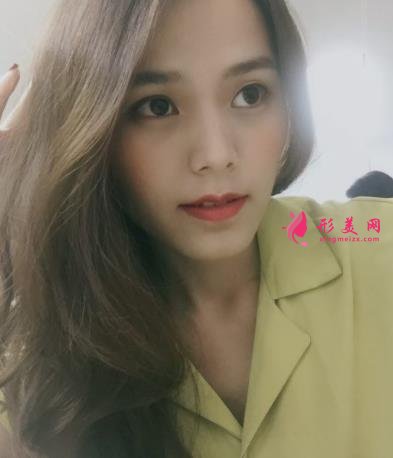 福州海峽美容醫(yī)院去眼袋怎么樣？技術(shù)特色、案例、價格收費雙雙公開