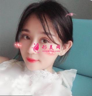 保定市第二醫(yī)院整形科新版價格表全網(wǎng)通告！內(nèi)含雙眼皮案例對比圖