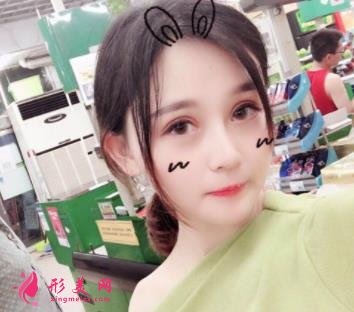 保定市第二醫(yī)院整形科新版價格表全網(wǎng)通告！內(nèi)含雙眼皮案例對比圖