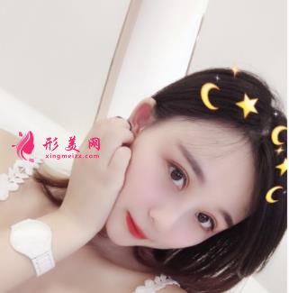 保定市第二醫(yī)院整形科新版價格表全網(wǎng)通告！內(nèi)含雙眼皮案例對比圖