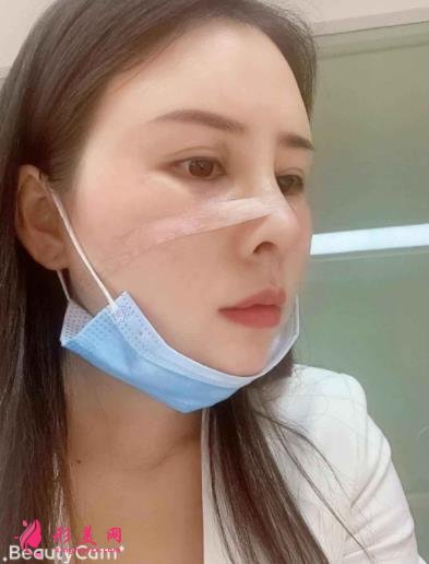 南京鼻祖整形醫(yī)院怎么樣？案例前后變化圖及隆鼻價(jià)格價(jià)目表分享