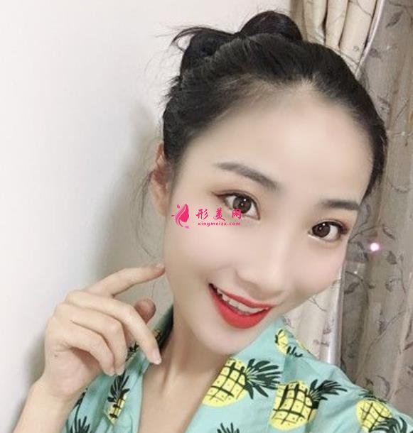貴州省人民醫(yī)院瘦臉針價(jià)格公示，醫(yī)美老司機(jī)吐血分享，全是干貨