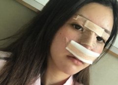 鄭大一附院整形科做鼻子怎么樣？醫(yī)生案例及價格價目表公開反饋