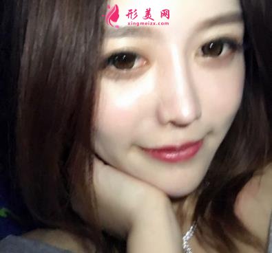 鄭大一附院整形科做鼻子怎么樣？醫(yī)生案例及價(jià)格價(jià)目表公開反饋