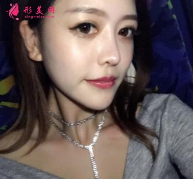 鄭大一附院整形科做鼻子怎么樣？醫(yī)生案例及價(jià)格價(jià)目表公開反饋