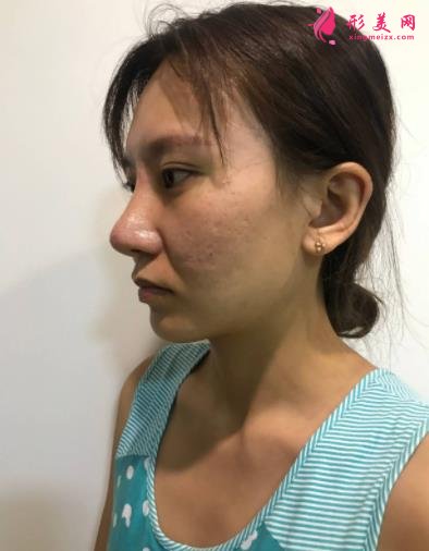 廣州廣大整形醫(yī)院面部輪廓價(jià)格價(jià)目表公開(kāi)!含實(shí)拍案例圖分享!