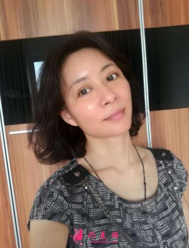 北京瑞麗馮立哲多維拉面部提升怎么樣？案例及效果圖公開查詢
