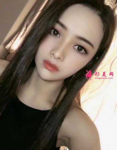 寧波壹加壹整形醫(yī)院怎么樣？從簡介及激光去眼袋案例、價(jià)格收費(fèi)可以看出