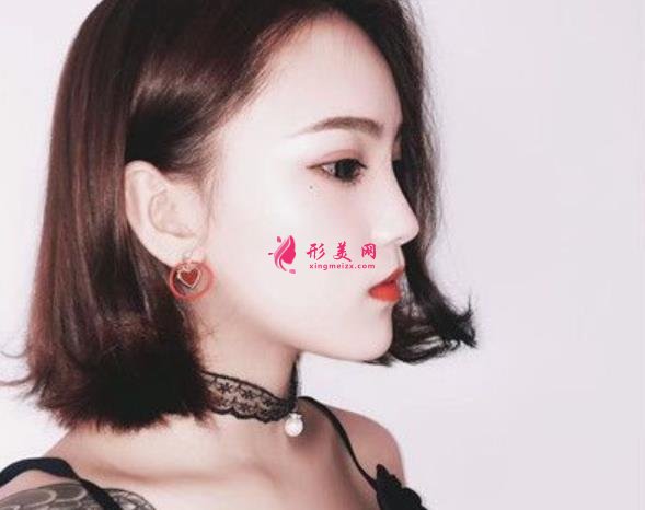 瑞麗整形醫(yī)院鼻綜合怎么樣？上海小姐姐分享不一樣的隆鼻子