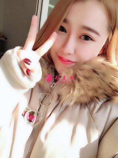 徐州醫(yī)院雙眼皮做得好嗎？案例效果分享_眼部修復(fù)干貨盤點(diǎn)