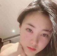 哈醫(yī)大一院美容科雙眼皮怎么樣？恢復(fù)效果分享_手術(shù)后如何護理?