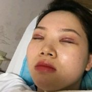 天津公安醫(yī)院雙眼皮怎么樣？哪些人不能做雙眼皮手術(shù)？