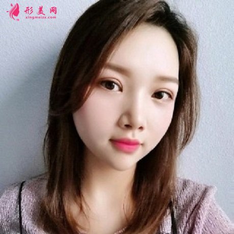 天津公安醫(yī)院雙眼皮怎么樣？哪些人不能做雙眼皮手術(shù)？