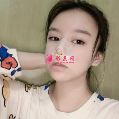 蘇州昆山百達(dá)麗醫(yī)療美容靠譜嗎？做鼻子真實(shí)案例及價(jià)目表_口碑介紹