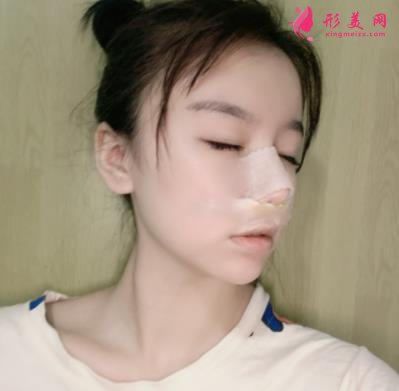 蘇州昆山百達(dá)麗醫(yī)療美容靠譜嗎？做鼻子真實(shí)案例及價(jià)目表_口碑介紹